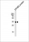 EPHB2 Antibody