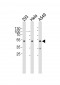 CBX8 Antibody (C-term)