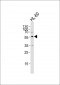 ENT1 Antibody (Center)