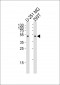 CPM Antibody (Center)