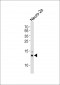 SUMO1 Antibody (N-term)