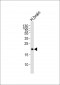 Hippocalcin Antibody (N-term)