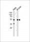ATG4C Antibody (C-term)