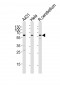 KISS1R Antibody (Center)