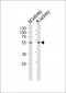CNDP1 Antibody (Center)
