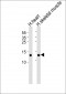 FABP3 Antibody