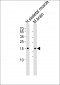 CFL2 Antibody (C-term)