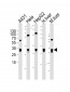 ETFA Antibody (Center)