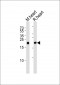 PRDX2 Antibody (C-term)