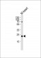 FOLR2 Antibody (N-term)