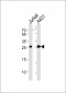 RAB7L1 Antibody