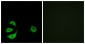 ACOT8 Antibody