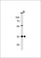 ACOT8 Antibody