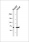 SLC28A2 Antibody