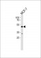 EIF2B3 Antibody