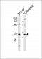 CATZ Antibody (Cleaved-Leu62)