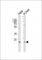 YTHDF1 Antibody