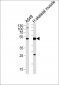 NT5C1A Antibody