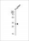 ELOVL1 Antibody