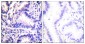 Synuclein γ Antibody