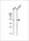 CMKLR1 Antibody