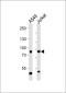 PNPLA8 Antibody