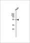 CCT7 Antibody