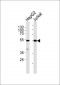 PAR4 (Cleaved-Gly48) Antibody