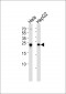 MRRF Antibody