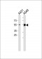 Keratin 8 Antibody