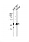 ALDOB Antibody