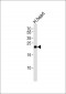 FGF13 Antibody