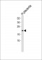 DLX4 Antibody