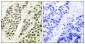 DNA Polymerase β Antibody