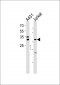 DNA Polymerase β Antibody
