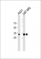 CYB5R3 Antibody