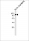 THRB Antibody (AP2, Cleaved-Arg327)