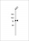 C1S Antibody (heavy chain, Cleaved-Arg437) 