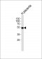 Cytochrome P450 11A1 Antibody