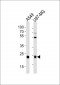 CATL1 Antibody (heavy chain, Cleaved-Thr288)