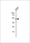 CDK5RAP3 Antibody