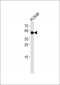 ALDH1B1 Antibody