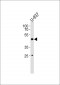 CD153 Antibody