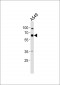 CSTF2 Antibody