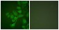 TIMP2 Antibody