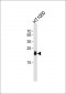 TIMP2 Antibody