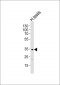 MAT1 Antibody