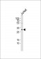 Caspase 7 (Cleaved-Asp198) Antibody