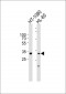 ZNF265 Antibody