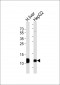 FABP1 Antibody